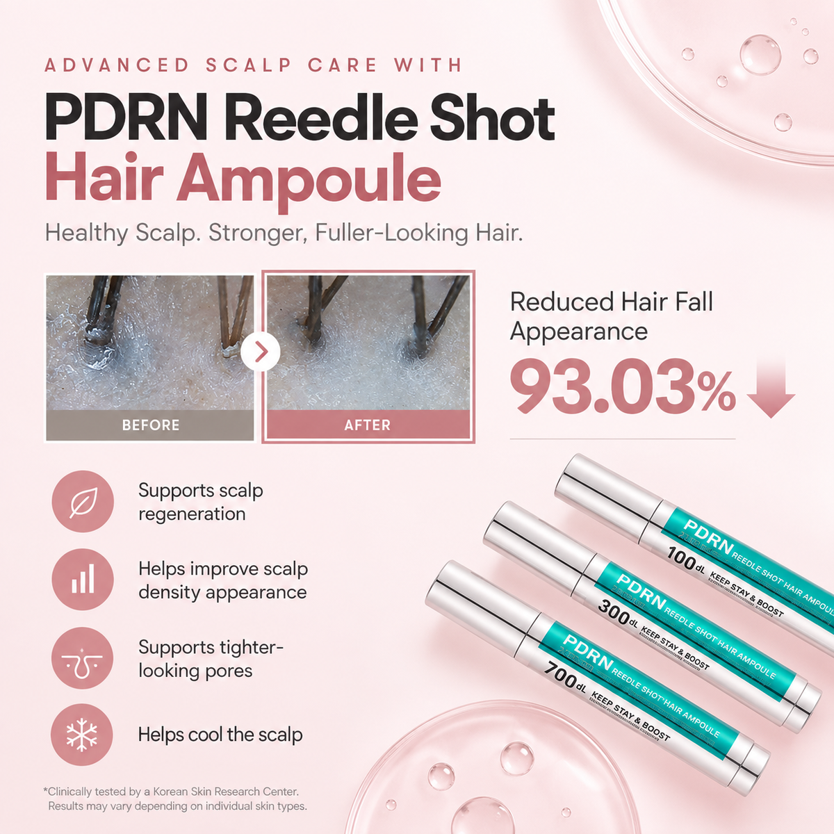 Reedle Shot - Targeted Hair Thickening