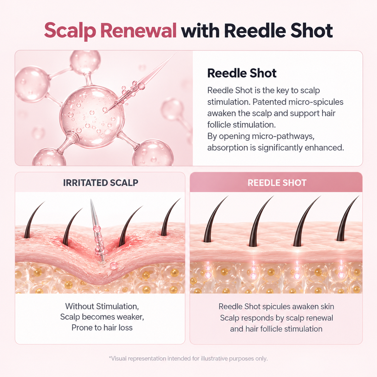 Reedle Shot - Targeted Hair Thickening