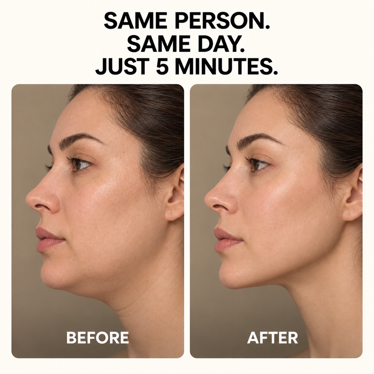 Mistym Radiance Pro: At-Home Face & Neck Lift